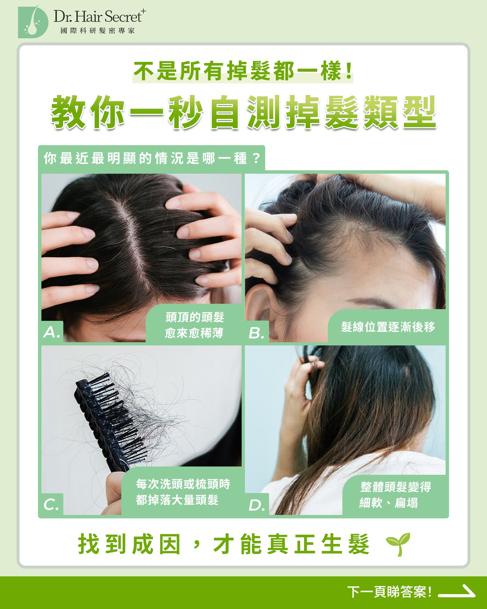 不是所有掉髮都一樣
