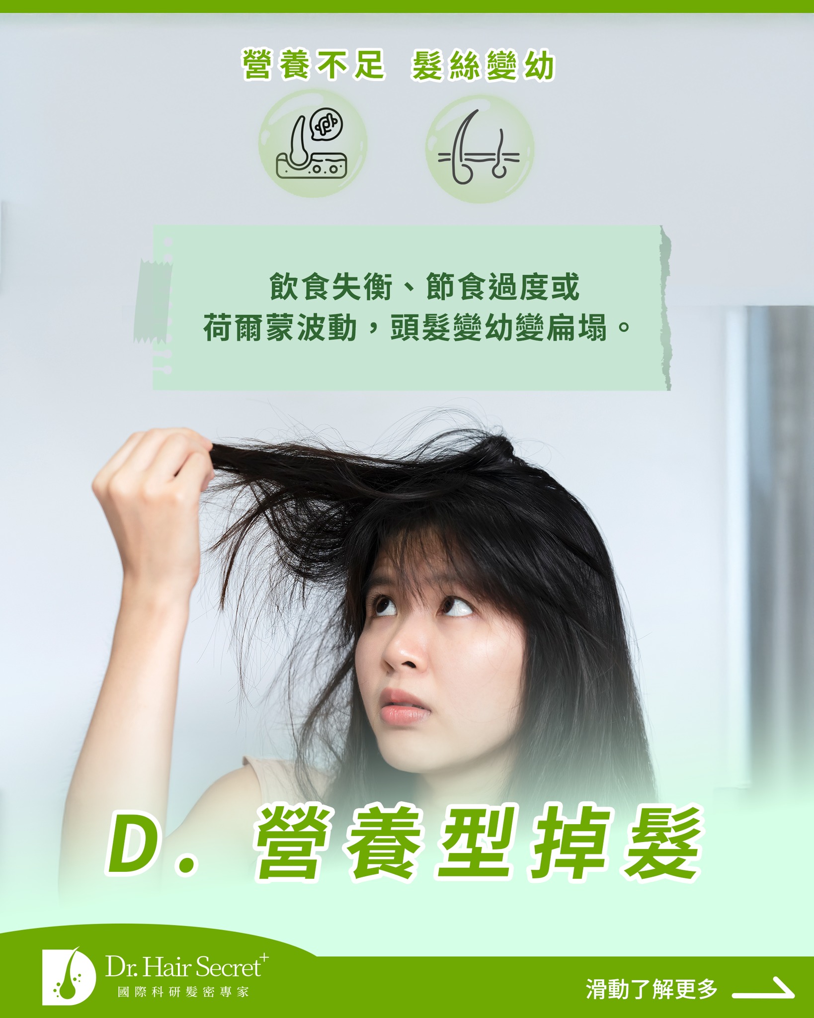 C. 壓力型掉髮